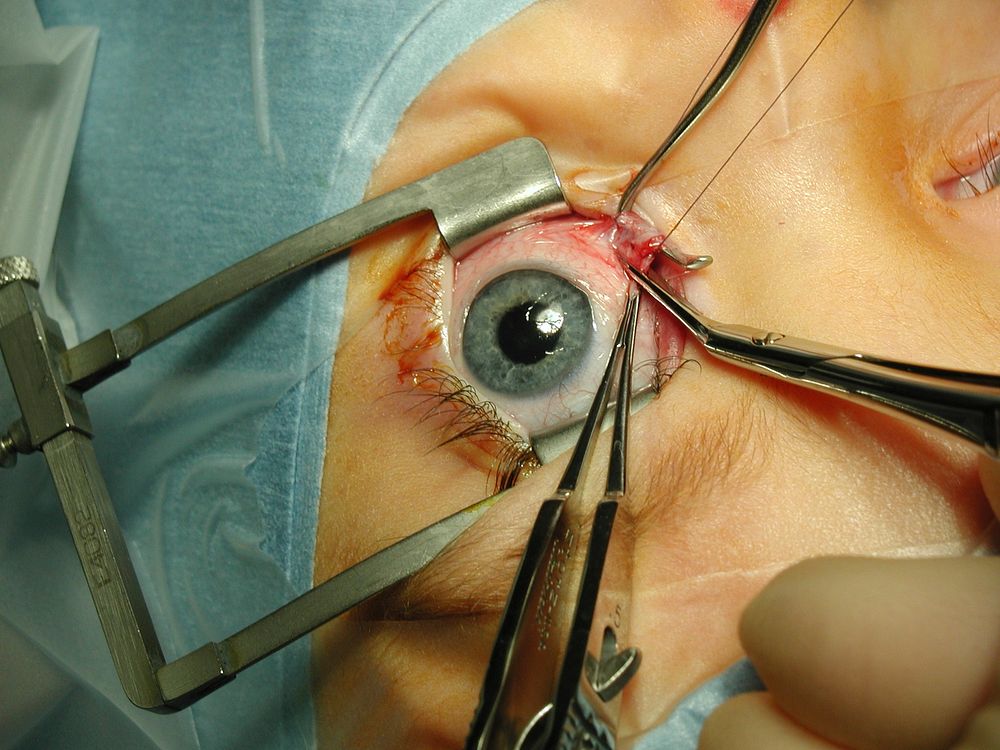 Eye Instruments