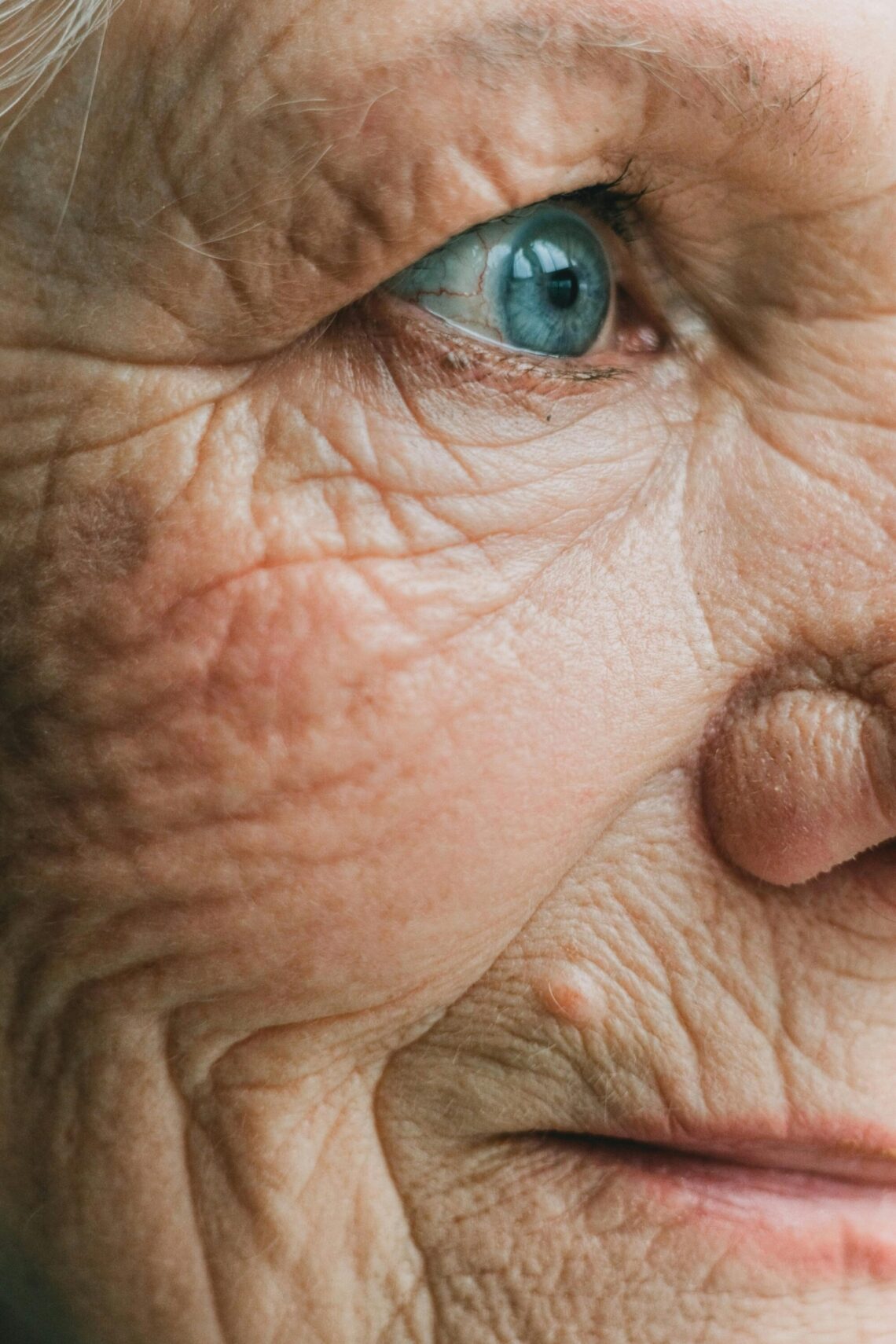 Common Types of Cataracts in Seniors and Their Symptoms Common Types of Cataracts in Seniors and Their Symptoms