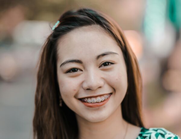 Transform Your Smile with Expert Braces Treatment