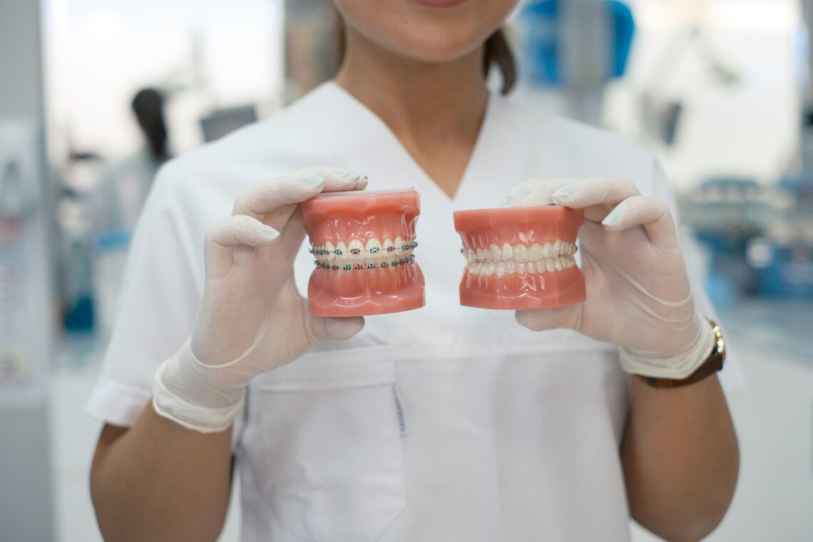 Why More People Are Investing in Orthodontic Treatment for a Healthier Smile