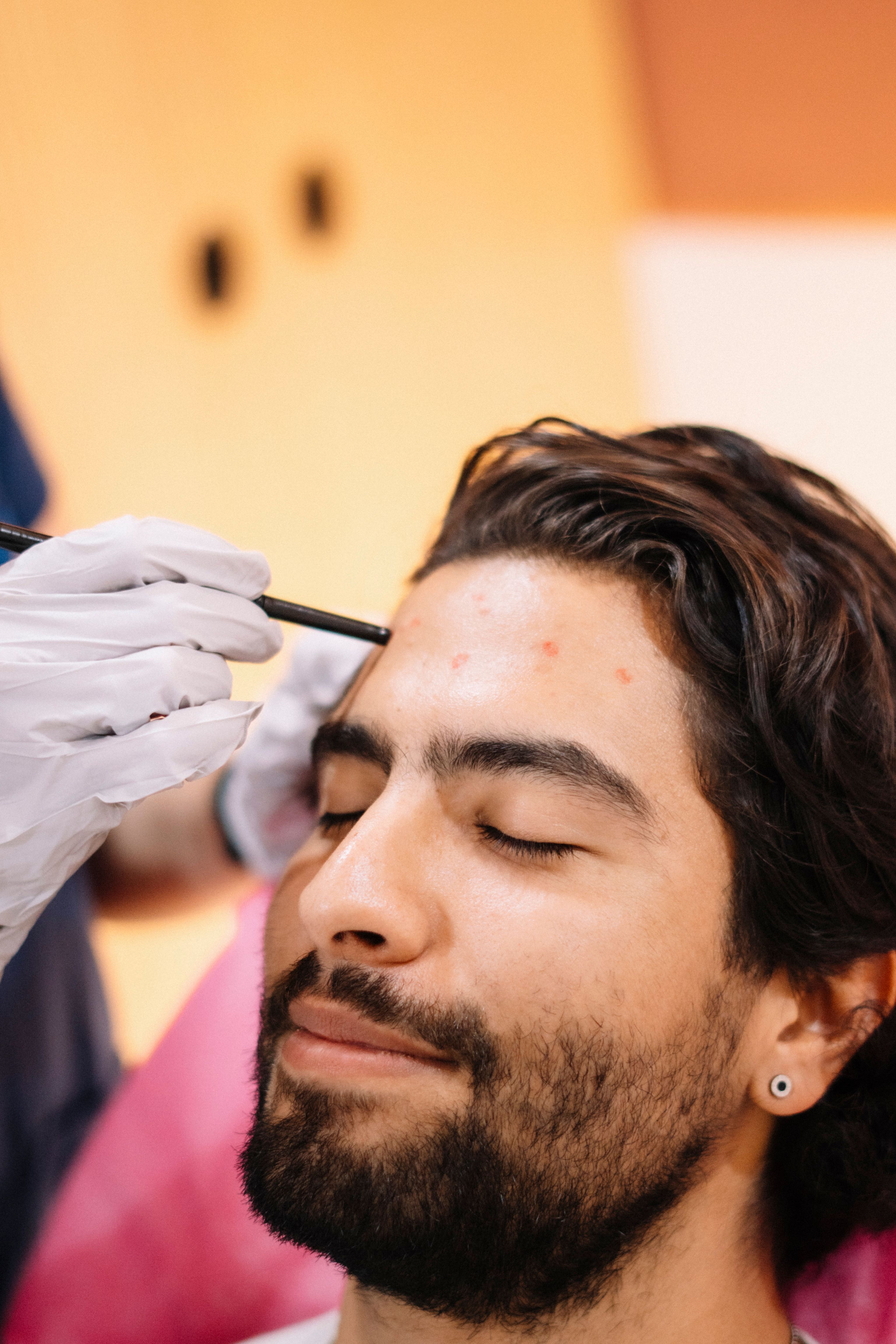 Hair Transplant vs Men’s Hair Systems Cost and Lifespan