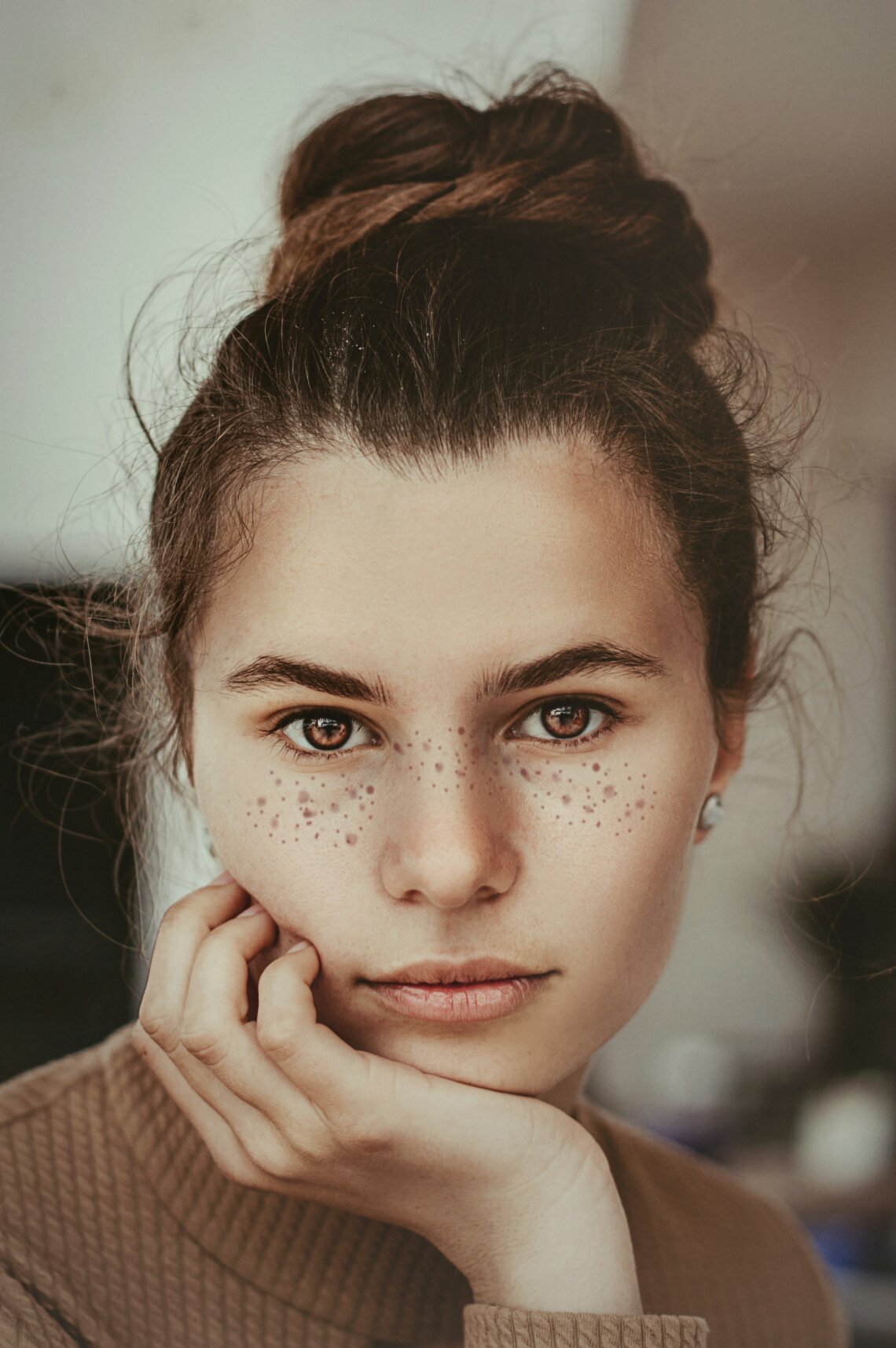 What are Dark Spots and how to Fade Them?